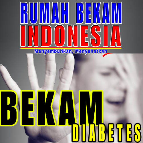 Bekam dIABETES