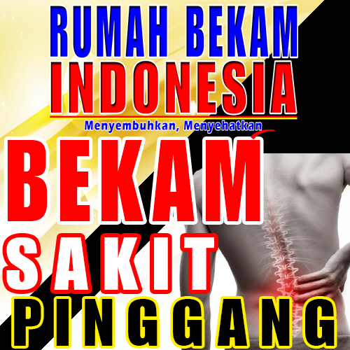 Bekam sakit pinggang